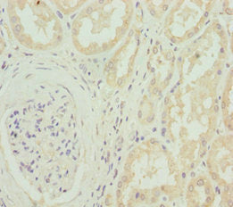 Immunohistochemistry of paraffin-embedded human kidney tissue using CACNB1 Antibody at dilution of 1:100