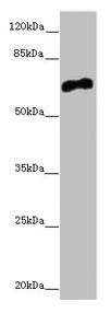 Western blot  | All lanes: CACNB1 antibody at 6.68µg/ml + HepG2 whole cell lysate  | Secondary  | Goat polyclonal to rabbit IgG at 1/10000 dilution  | Predicted band size: 66, 58, 54 kDa  | Observed band size: 66 kDa