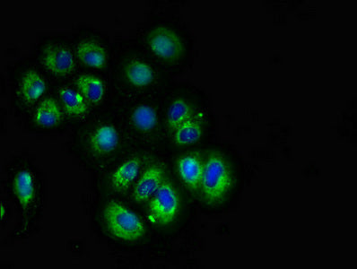Immunofluorescent analysis of A549 cells using CACNG3 Antibody at dilution of 1:100 and Alexa Fluor 488-congugated AffiniPure Goat Anti-Rabbit IgG(H+L)