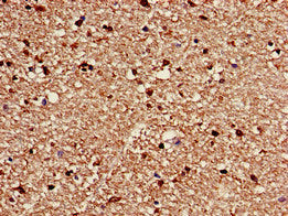 Immunohistochemistry of paraffin-embedded human brain tissue using CACNG3 Antibody at dilution of 1:100