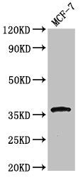 Western Blot  | Positive WB detected in: MCF-7 whole cell lysate  | All lanes: CACNG3 antibody at 3.4μg/ml  | Secondary  | Goat polyclonal to rabbit IgG at 1/50000 dilution  | Predicted band size: 36 kDa  | Observed band size: 36 kDa