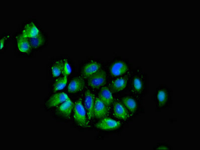Immunofluorescent analysis of A549 cells using CADM3 Antibody at dilution of 1:100 and Alexa Fluor 488-congugated AffiniPure Goat Anti-Rabbit IgG(H+L)