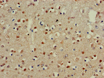 Immunohistochemistry of paraffin-embedded human brain tissue using the antibody at dilution of 1:100