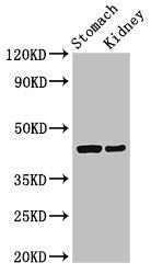Western Blot | Positive WB detected in: Rat stomach tissue, Mouse kidney tissue | All lanes: CADM3 antibody at 3μg/ml | Secondary | Goat polyclonal to rabbit IgG at 1/50000 dilution | Predicted band size: 44, 48, 39 kDa | Observed band size: 44 kDa
