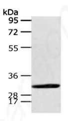 Gel: 8%SDS-PAGE  Lysate: 40μg     Lane: Human fetal brian tissue   Primary antibody: CALB2 Antibody at dilution 1/400 dilution  Secondary antibody: Goat anti rabbit IgG at 1/8000 dilution  Exposure time: 40 seconds