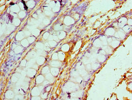 Immunohistochemistry of paraffin-embedded human colon tissue using CALD1 Antibody at dilution of 1:100