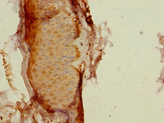 Immunohistochemistry of paraffin-embedded human skin tissue using CALML3 Antibody at dilution of 1:100