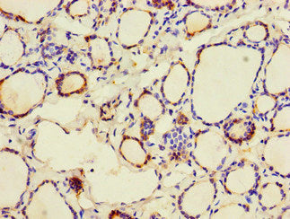 Immunohistochemistry of paraffin-embedded human thyroid tissue using CALR Antibody at dilution of 1:100