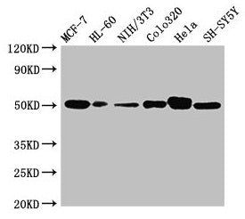 Western Blot | Positive WB detected in: MCF-7 whole cell lysate, HL60 whole cell lysate, NIH/3T3 whole cell lysate, Colo320 whole cell lysate, Hela whole cell lysate, SH-SY5Y whole cell lysate | All lanes: CALR antibody at 2μg/ml | Secondary | Goat polyclonal to rabbit IgG at 1/10000 dilution | Predicted band size: 49 kDa | Observed band size: 49 kDa