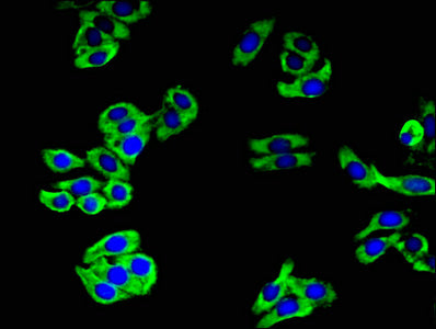 Immunofluorescent analysis of HepG2 cells using CAMLG Antibody at dilution of 1:100 and Alexa Fluor 488-congugated AffiniPure Goat Anti-Rabbit IgG(H+L)