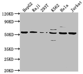 Western Blot | Positive WB detected in: HepG2 whole cell lysate, Raji whole cell lysate, 293T whole cell lysate, K562 whole cell lysate, Hela whole cell lysate, Jurkat whole cell lysate | All lanes: CAP1 antibody at 1:2000 | Secondary | Goat polyclonal to rabbit IgG at 1/50000 dilution | Predicted band size: 52 kDa | Observed band size: 52 kDa