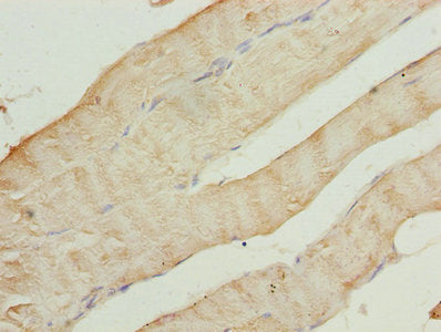 Immunohistochemistry of paraffin-embedded human skeletal muscle tissue using CAP2 Antibody at dilution of 1:100
