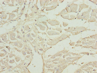 Immunohistochemistry of paraffin-embedded human heart tissue using CAP2 Antibody at dilution of 1:100
