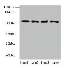 Western blot  | All lanes: CAP2 antibody at 4µg/ml  | Lane 1: HepG2 whole cell lysate  | Lane 2: Mouse muscle tissue  | Lane 3: Mouse gonadal tissue  | Lane 4: Hela whole cell lysate  | Secondary  | Goat polyclonal to rabbit IgG at 1/10000 dilution  | Predicted band size: 53, 46, 25 kDa  | Observed band size: 53 kDa