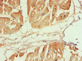 Immunohistochemistry of paraffin-embedded human heart tissue using CAPN1 Antibody at dilution of 1:100