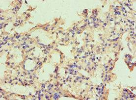 Immunohistochemistry of paraffin-embedded human lung tissue using CAPN1 Antibody at dilution of 1:100