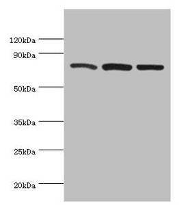 Western blot | All lanes: Calpain-1 catalytic subunit antibody at 2μg/ml | Lane 1: A431 whole cell lysate | Lane 2: Hela whole cell lysate | Lane 3: Jurkat whole cell lysate | Secondary | Goat polyclonal to rabbit IgG at 1/10000 dilution | Predicted band size: 82 kDa | Observed band size: 82 kDa