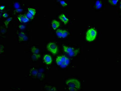 Immunofluorescence staining of MCF-7 cells with the antibody at 1:200, counter-stained with DAPI. The cells were fixed in 4% formaldehyde, permeabilized using 0.2% Triton X-100 and blocked in 10% normal Goat Serum. The cells were then incubated with the antibody overnight at 4°C. The secondary antibody was Alexa Fluor 488-congugated AffiniPure Goat Anti-Rabbit IgG(H+L).