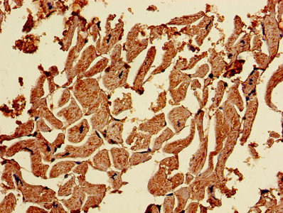 Immunohistochemistry of paraffin-embedded human heart tissue using CAPN1 Antibody at dilution of 1:100