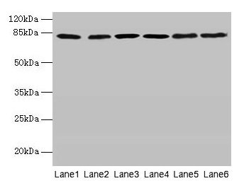 Western blot  | All lanes: CAPN1 antibody at 6µg/ml  | Lane 1: A375 whole cell lysate  | Lane 2: 293T whole cell lysate  | Lane 3: PC-3 whole cell lysate  | Lane 4: Jurkat whole cell lysate  | Lane 5: Hela whole cell lysate  | Lane 6: A2780 whole cell lysate  | Secondary  | Goat polyclonal to rabbit IgG at 1/10000 dilution  | Predicted band size: 82 kDa  | Observed band size: 82 kDa