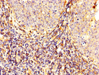IHC image of CAPN2 Antibody diluted at 1:300 and staining in paraffin-embedded human tonsil tissue performed on a Leica BondTM system. After dewaxing and hydration, antigen retrieval was mediated by high pressure in a citrate buffer (pH 6.0). Section was blocked with 10% normal goat serum 30min at RT. Then primary antibody (1% BSA) was incubated at 4°C overnight. The primary is detected by a biotinylated secondary antibody and visualized using an HRP conjugated SP system.