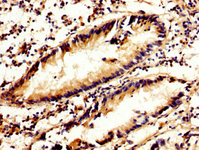 IHC image of CAPN2 Antibody diluted at 1:300 and staining in paraffin-embedded human appendix tissue performed on a Leica BondTM system. After dewaxing and hydration, antigen retrieval was mediated by high pressure in a citrate buffer (pH 6.0). Section was blocked with 10% normal goat serum 30min at RT. Then primary antibody (1% BSA) was incubated at 4°C overnight. The primary is detected by a biotinylated secondary antibody and visualized using an HRP conjugated SP system.