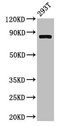 Western Blot  | Positive WB detected in: 293T whole cell lysate  | All lanes: CAPN2 antibody at 3.4µg/ml  | Secondary  | Goat polyclonal to rabbit IgG at 1/50000 dilution  | Predicted band size: 80, 72 kDa  | Observed band size: 80 kDa