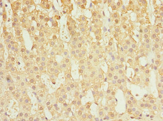 Immunohistochemistry of paraffin-embedded human adrenal gland tissue using CAPNS1 Antibody at dilution of 1:100