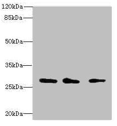 Western blot  | All lanes: CAPNS1 antibody at 1.15µg/ml  | Lane 1: Mouse lung tissue  | Lane 2: Mouse brain tissue  | Lane 3: Hela whole cell lysate  | Secondary  | Goat polyclonal to rabbit IgG at 1/10000 dilution  | Predicted band size: 28 kDa  | Observed band size: 28 kDa