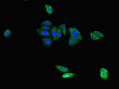 Immunofluorescent analysis of HepG2 cells using CAPZA1 Antibody at dilution of 1:100 and Alexa Fluor 488-congugated AffiniPure Goat Anti-Rabbit IgG(H+L)