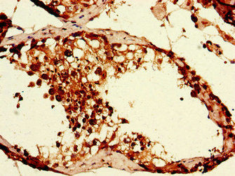 Immunohistochemistry of paraffin-embedded human testis tissue using CAPZA1 Antibody at dilution of 1:100