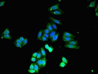 Immunofluorescent analysis of HepG2 cells using CASP4 Antibody at dilution of 1:100 and Alexa Fluor 488-congugated AffiniPure Goat Anti-Rabbit IgG(H+L)