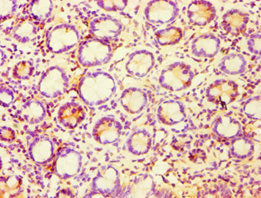 Immunohistochemistry of paraffin-embedded human small intestine tissue using CASP6 Antibody at dilution of 1:100