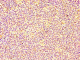 Immunohistochemistry of paraffin-embedded human tonsil tissue using CASP6 Antibody at dilution of 1:100