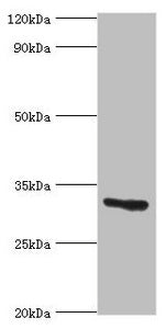 Western blot | All lanes: Caspase-6 antibody at 8μg/ml + Hela whole cell lysate | Secondary | Goat polyclonal to rabbit IgG at 1/10000 dilution | Predicted band size: 34, 23 kDa | Observed band size: 34 kDa