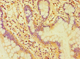 Immunohistochemistry of paraffin-embedded human small intestine tissue using CASP6 Antibody at dilution of 1:100