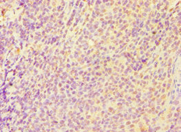 Immunohistochemistry of paraffin-embedded human tonsil tissue using CASP6 Antibody at dilution of 1:100