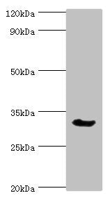 Western blot | All lanes: Caspase-6 antibody at 3μg/ml + Mouse liver tissue | Secondary | Goat polyclonal to rabbit IgG at 1/10000 dilution | Predicted band size: 34, 23 kDa | Observed band size: 34 kDa
