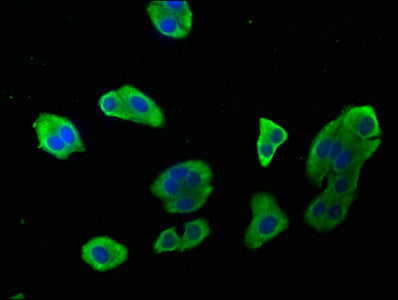 Immunofluorescence staining of HepG2 cells with CASP9 Antibody at 1:142, counter-stained with DAPI. The cells were fixed in 4% formaldehyde, permeabilized using 0.2% Triton X-100 and blocked in 10% normal Goat Serum. The cells were then incubated with the antibody overnight at 4°C. The secondary antibody was Alexa Fluor 488-congugated AffiniPure Goat Anti-Rabbit IgG(H+L).