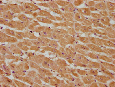 IHC image of CASP9 Antibody diluted at 1:285 and staining in paraffin-embedded human heart tissue performed on a Leica BondTM system. After dewaxing and hydration, antigen retrieval was mediated by high pressure in a citrate buffer (pH 6.0). Section was blocked with 10% normal goat serum 30min at RT. Then primary antibody (1% BSA) was incubated at 4°C overnight. The primary is detected by a biotinylated secondary antibody and visualized using an HRP conjugated SP system.