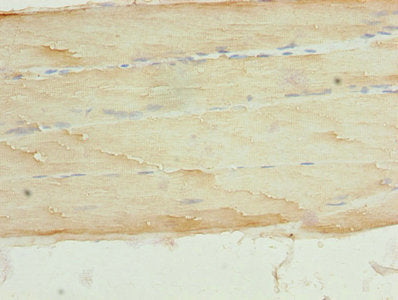 Immunohistochemistry of paraffin-embedded human skeletal muscle tissue using CASQ1 Antibody at dilution of 1:100