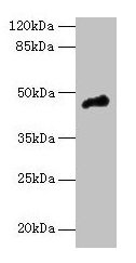 Western blot  | All lanes: CASQ1 antibody at 5µg/ml + Mouse brain tissue  | Secondary  | Goat polyclonal to rabbit IgG at 1/10000 dilution  | Predicted band size: 46 kDa  | Observed band size: 46 kDa