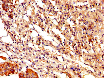 IHC image of CAST Antibody diluted at 1:500 and staining in paraffin-embedded human adrenal gland tissue performed on a Leica BondTM system. After dewaxing and hydration, antigen retrieval was mediated by high pressure in a citrate buffer (pH 6.0). Section was blocked with 10% normal goat serum 30min at RT. Then primary antibody (1% BSA) was incubated at 4°C overnight. The primary is detected by a biotinylated secondary antibody and visualized using an HRP conjugated SP system.