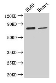 Western Blot  | Positive WB detected in: HL60 whole cell lysate, Mouse heart tissue  | All lanes: CAST antibody at 2.6µg/ml  | Secondary  | Goat polyclonal to rabbit IgG at 1/50000 dilution  | Predicted band size: 77, 76, 64, 72, 82, 85, 83, 75, 81 kDa  | Observed band size: 77 kDa