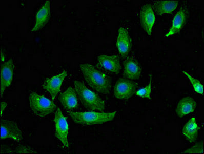 Immunofluorescent analysis of A549 cells using CAV2 Antibody at dilution of 1:100 and Alexa Fluor 488-congugated AffiniPure Goat Anti-Rabbit IgG(H+L)
