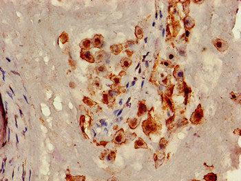 Immunohistochemistry of paraffin-embedded human placenta tissue using the antibody at dilution of 1:100