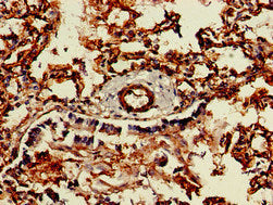 Immunohistochemistry of paraffin-embedded human lung tissue using CAV2 Antibody at dilution of 1:100