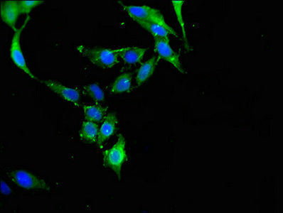 Immunofluorescent analysis of Hela cells using CBL Antibody at dilution of 1:100 and Alexa Fluor 488-congugated AffiniPure Goat Anti-Rabbit IgG(H+L)