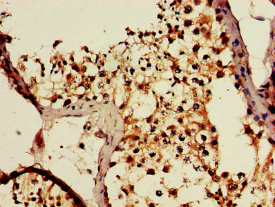 IHC image of CBL Antibody diluted at 1:600 and staining in paraffin-embedded human testis tissue performed on a Leica BondTM system. After dewaxing and hydration, antigen retrieval was mediated by high pressure in a citrate buffer (pH 6.0). Section was blocked with 10% normal goat serum 30min at RT. Then primary antibody (1% BSA) was incubated at 4°C overnight. The primary is detected by a biotinylated secondary antibody and visualized using an HRP conjugated SP system.