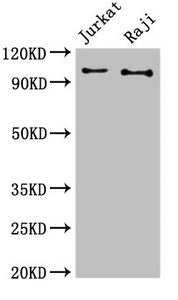 Western Blot  | Positive WB detected in: Jurkat whole cell lysate, Raji whole cell lysate  | All lanes: CBL antibody at 3µg/ml  | Secondary  | Goat polyclonal to rabbit IgG at 1/50000 dilution  | Predicted band size: 100 kDa  | Observed band size: 100 kDa